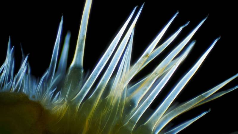 Stinging Hairs of the Stinging Nettle