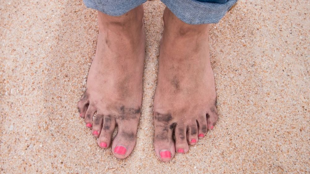 Dirty feet promote blister formation while hiking