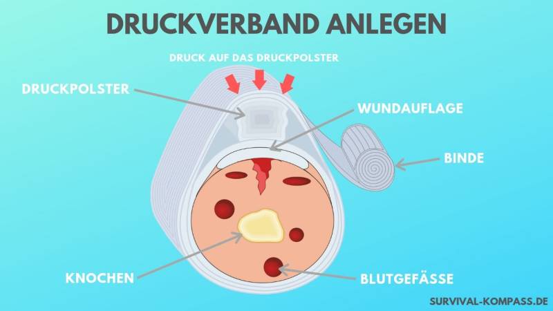 druckverband anlegen infografik