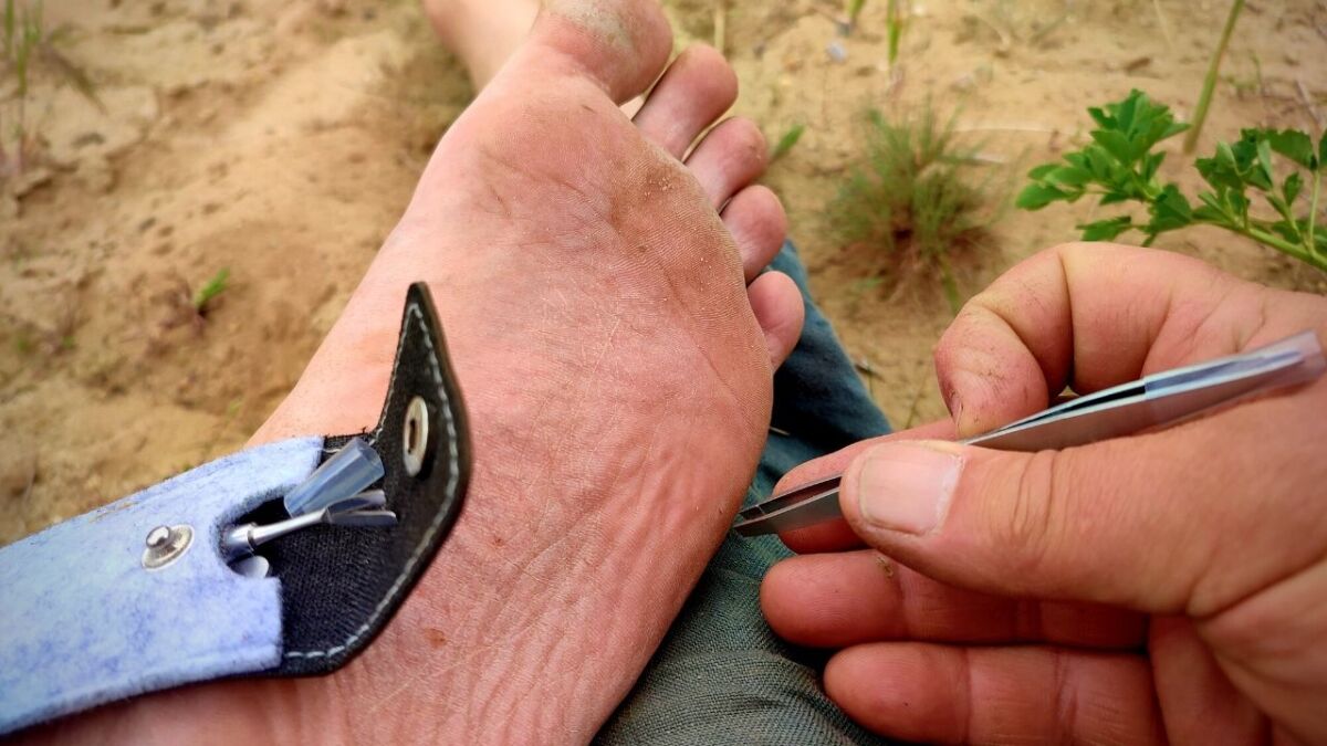 Check your feet regularly for scratches, splinters, and thorns