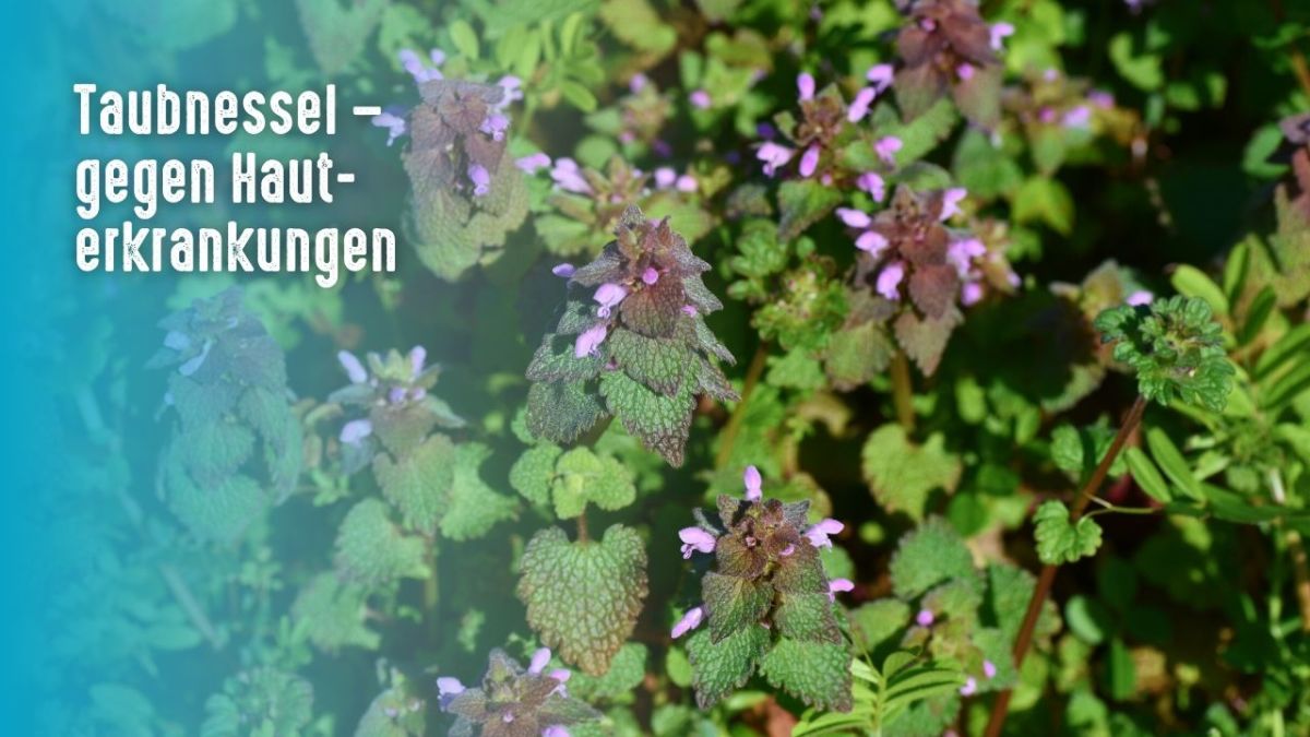 Dead-nettle is an herb that is widespread in Germany, Austria, and Switzerland. The plant has been used as a remedy for many ailments, including pain relief, muscle aches, and digestive problems.