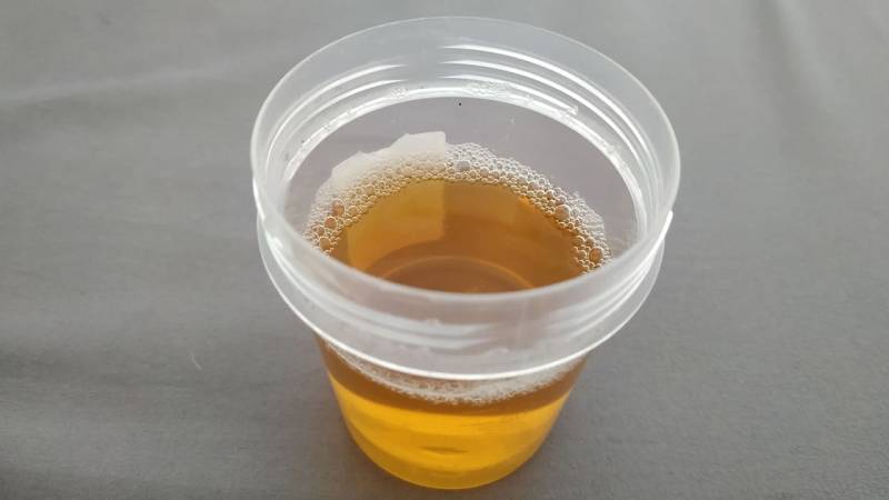 Can you drink urine? Is it safe? Can you drink it in an emergency?