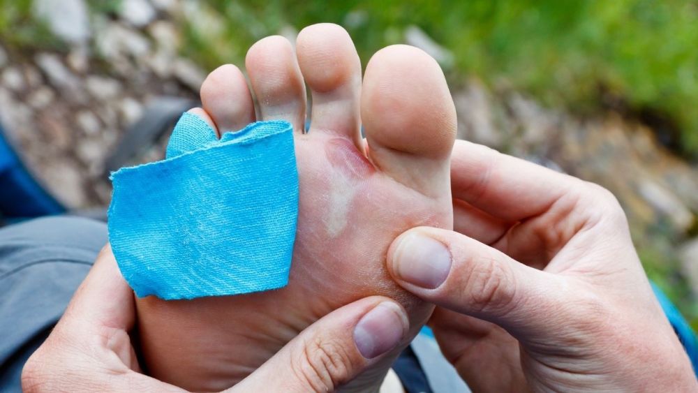 Moist feet can lead to blisters