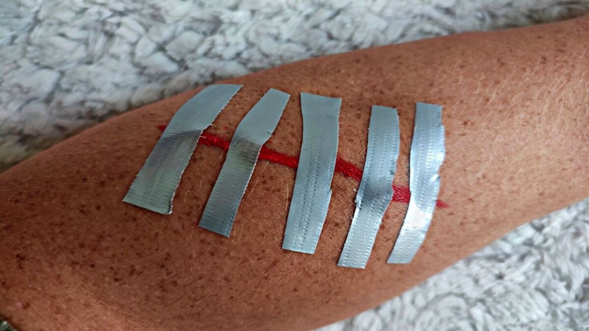 How to treat a wound in an emergency with duct tape
